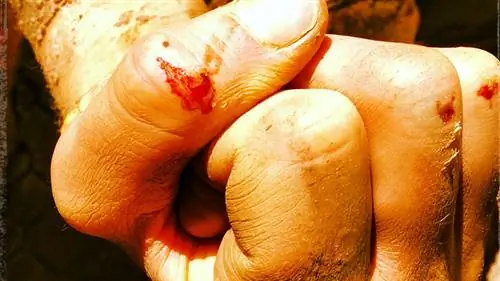 Кровоточащие руки