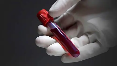 Тестостерон-Кровь-Тесты-Мусор