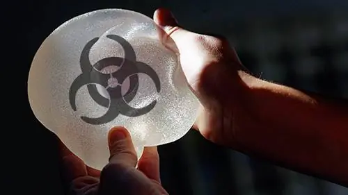 Токсичные грудные имплантаты