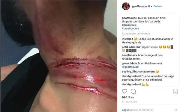 Джеффри Соуп показывает жестокие травмы после столкновения с забором из колючей проволоки