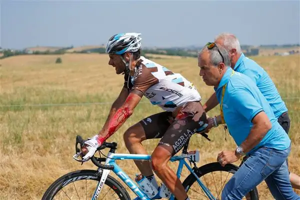 Как лечить дорожную сыпь & что делать при аварии