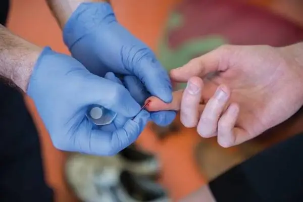 VO2 макс. молочная кислота