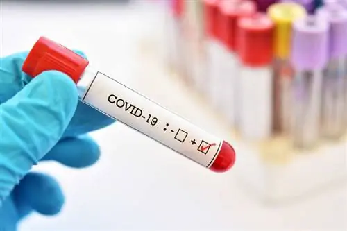 Тест на коронавирус Covid 19