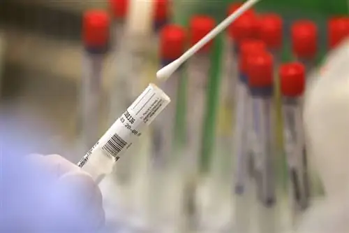 Исследователи нашли объяснение, почему пациенты с Covid-19 теряют обоняние