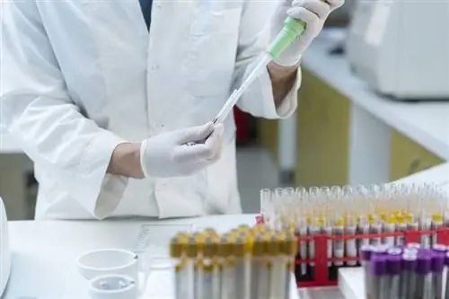 Covid-19: говорят, что группа крови влияет на течение болезни