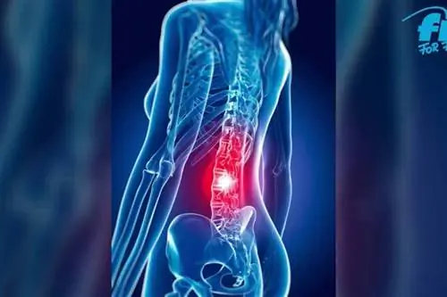 Эффективно борется с болью в спине при ишиасе