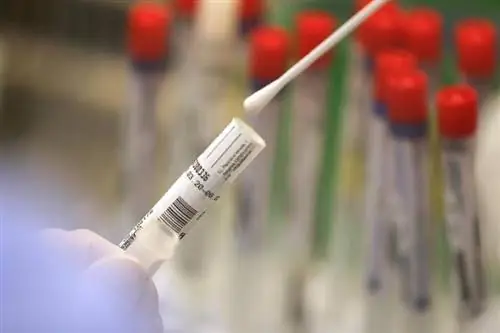 Цифры RKI с воскресенья: 1387 новых коронных инфекций - заболеваемость 13, 8