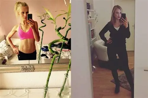 Леа до и после сравнения