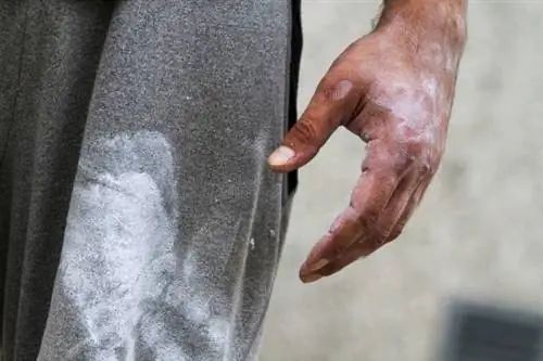 боль в шее, восстановление после травмы, работа с травмой, тренировка с травмой