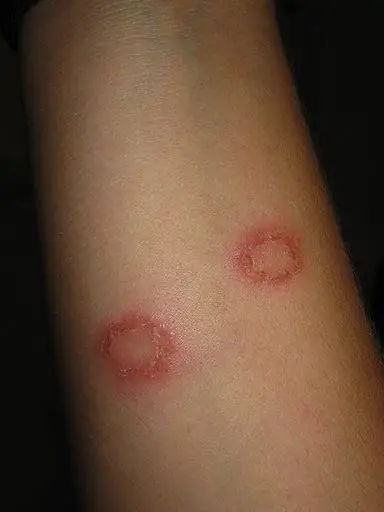 чистота в спортзале, стафилококковая инфекция, микробы в спортзале, грипп, уборка в спортзале