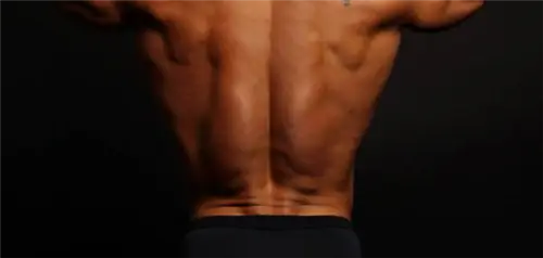 поясничный отдел, поясница, реабилитация, физика, многораздельный, лордоз, функциональный