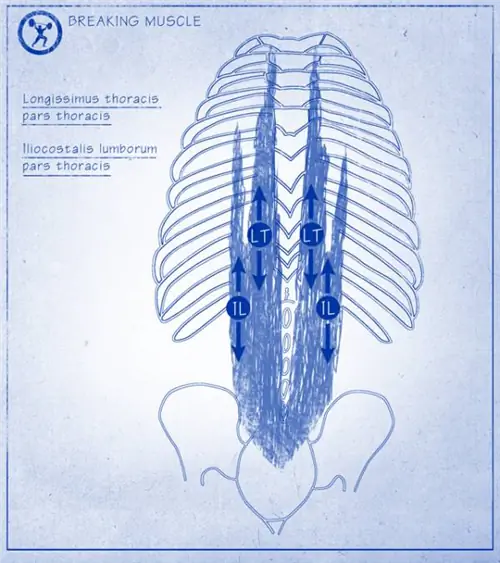 поясничный отдел, поясница, реабилитация, физика, многораздельный, лордоз, функциональный
