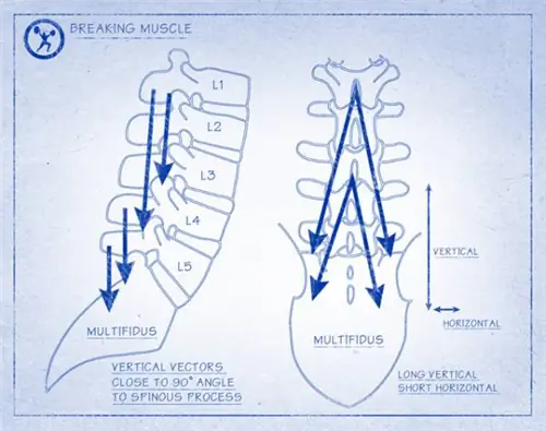 поясничный отдел, поясница, реабилитация, физика, многораздельный, лордоз, функциональный