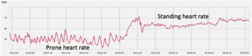 велосипедное тестирование, велосипедный фитнес велосипедное тестирование, велосипедный фитнес