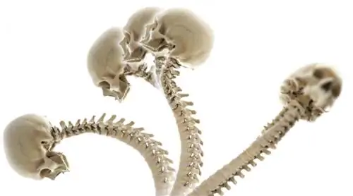 Подвижность середины спины: сила с поворотом