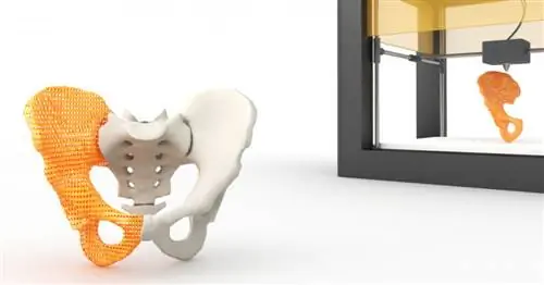 3D-печать и будущее искусственных костей
