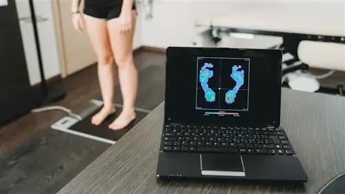 Женщине делают сканирование стопы