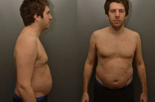 andy_goldstein_before andy_goldstein_before