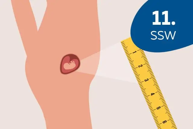 Какого размера гайка 3/8?