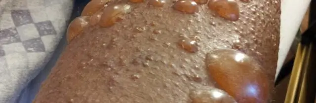 Что на самом деле показывают пузыри?