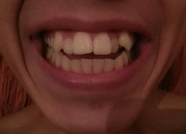 Сколько стоит крытый каток?