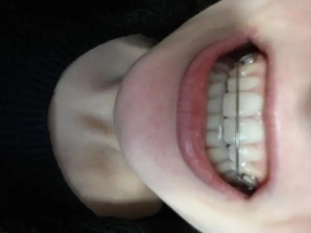 Как мне узнать размер моего водомера?