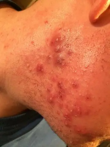 Что хорошего в дереве конского глаза?