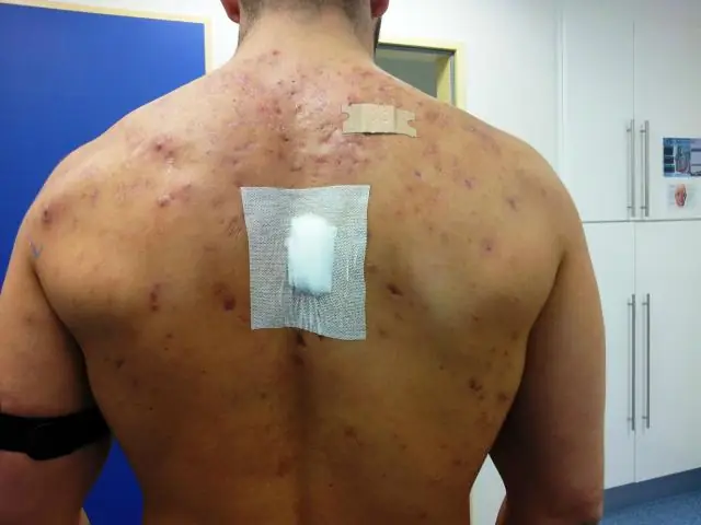 Как долго я могу принимать инъекции тестостерона?