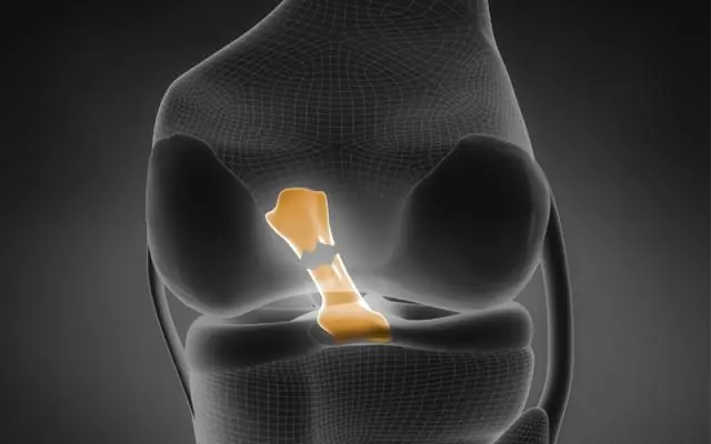 Как отремонтировать настил из стекловолокна?