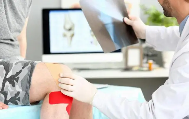 Как вы относитесь к EPM?