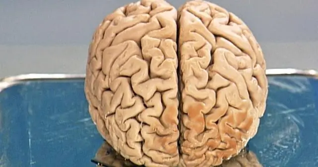 Как узнать, доминирует ли ваше правое или левое полушарие?