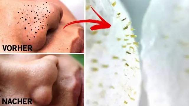 Как удалить пятна мочи летучих мышей?