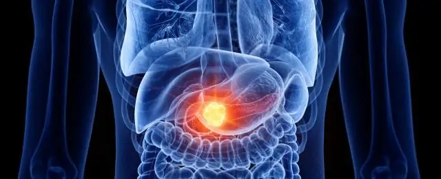 Где находится CCS?