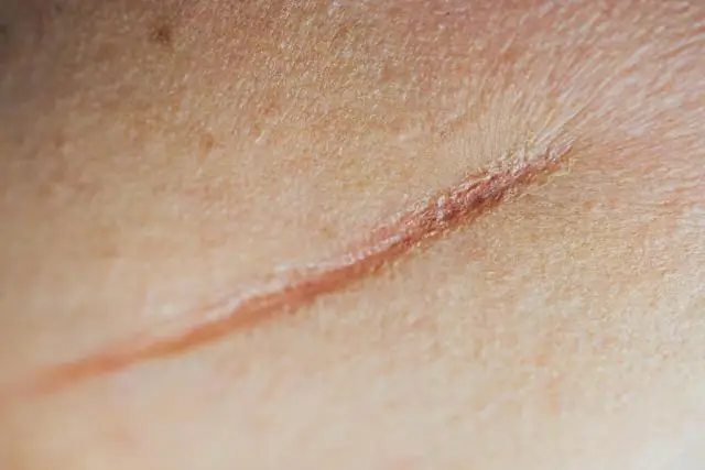 Что образует рубцы на створках моллюсков?